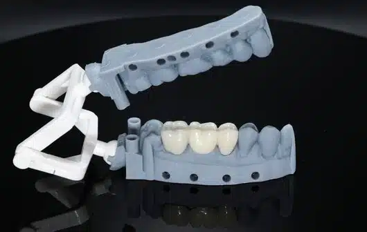 Popular Types of Zirconia Crowns in Dentistry