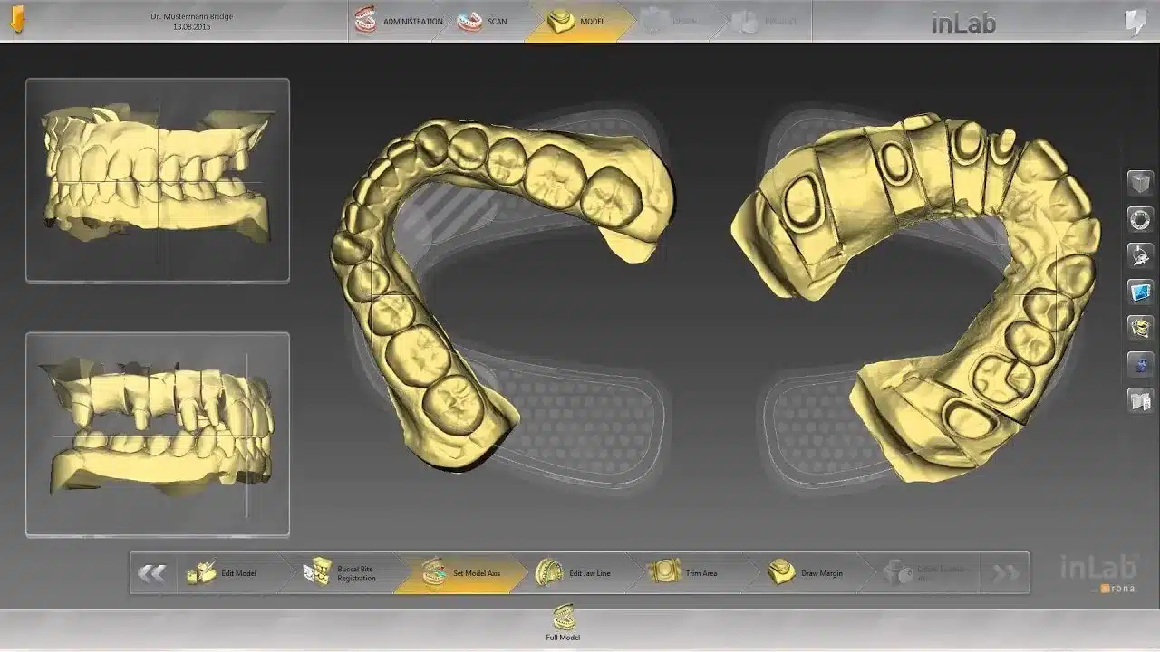 Explore The Amazing Benefits Of CAD/CAM Dentistry