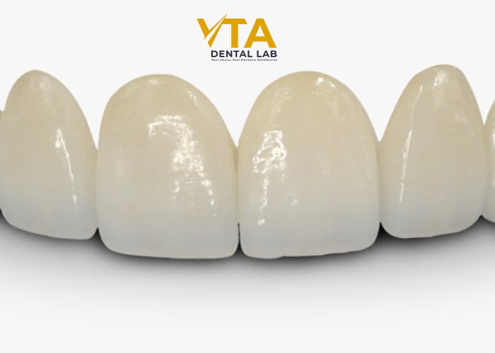 Accurate Understanding Of Anterior Bridge