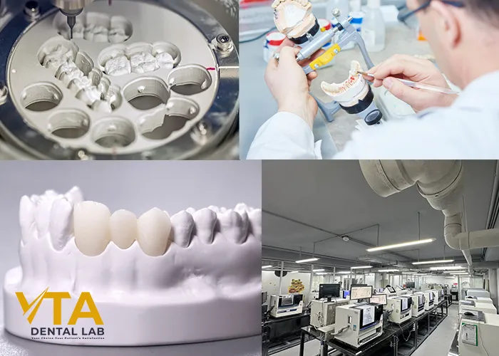 Cosmetic Dental Lab: Important Criteria For Evaluating