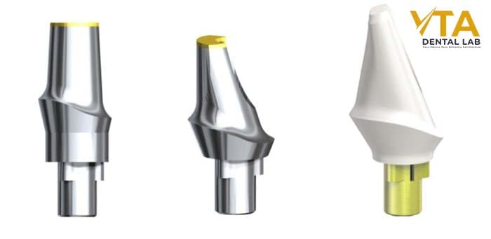 Abutments are quite simply the connector between the implant and the prosthesis