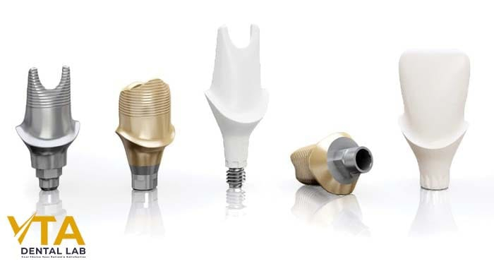 The custom abutment is tailor-made for the patient