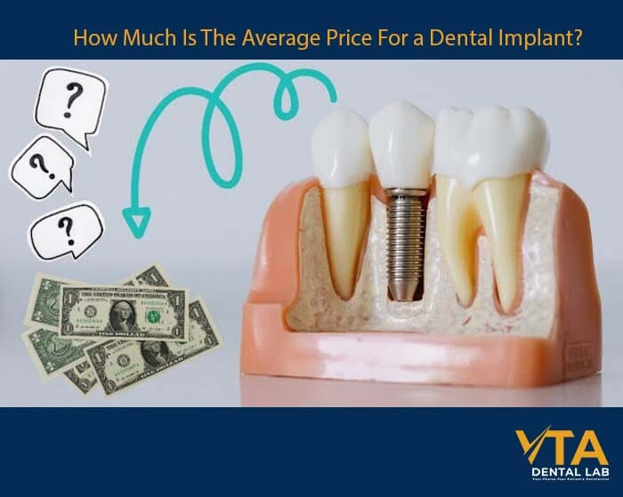 The average price for a dental implant