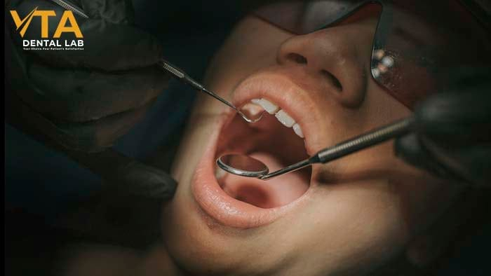 Bone grafts can increase the cost of dental implants