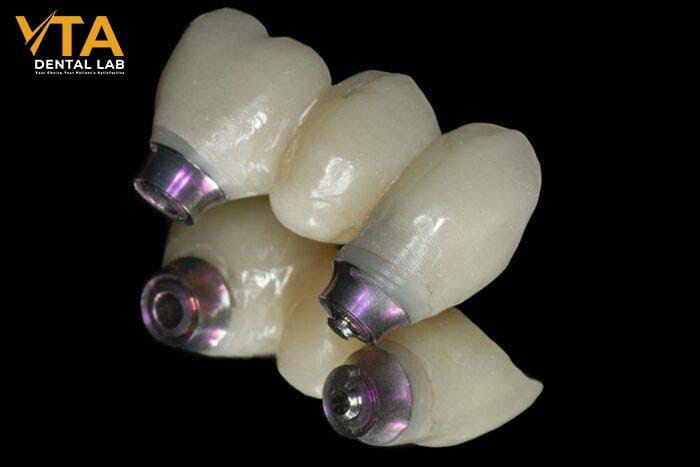 Dental implants can also replace multiple missing teeth