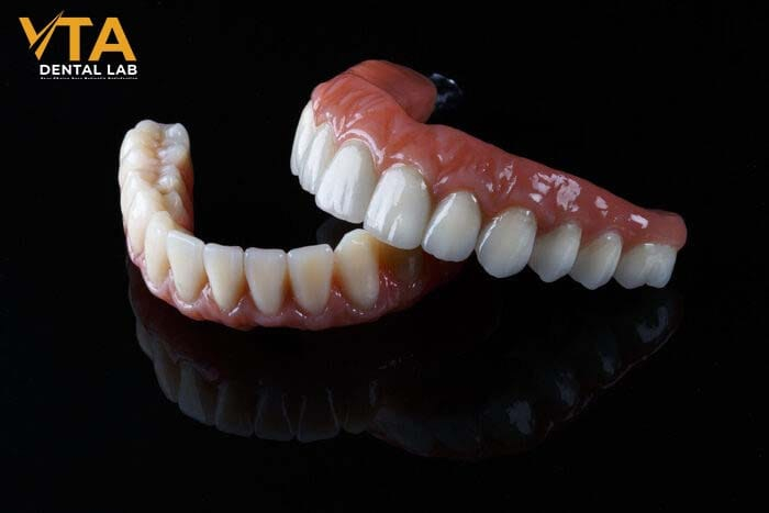 The price tag on implant posts affects the cost of full denture implants