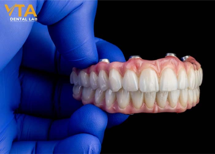 Implant-supported dentures will not slip or cause discomfort