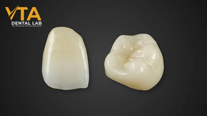 Comprehensive Guide To Dental Crowns And Bridges