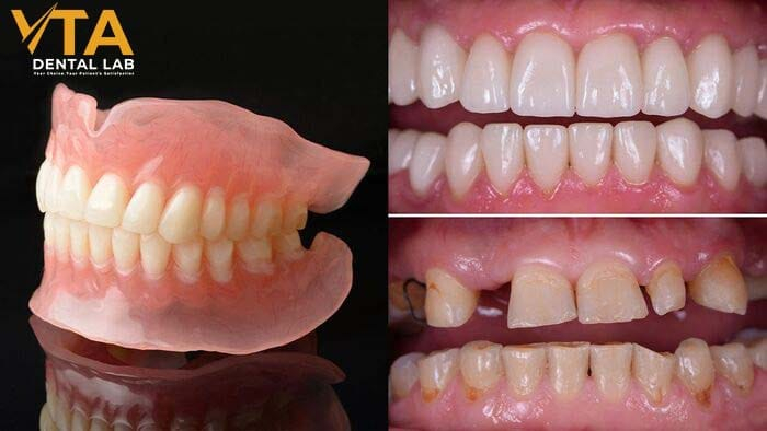 Addressing gum disease can maintain a solid foundation for other restorative treatments