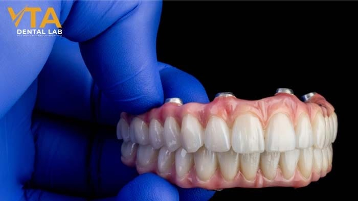 30+ Dental Implant Images Before & After