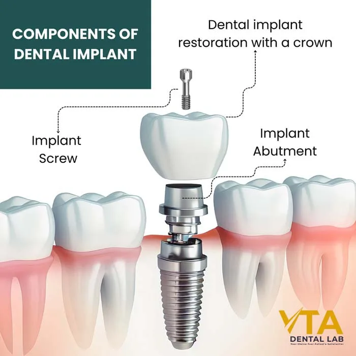 Dental implant are medical devices surgically implanted into the jaw