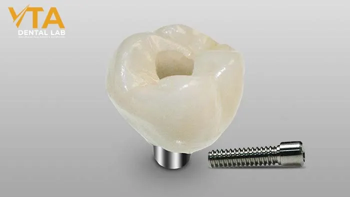 Screw-Retained Crown in the Implant Restorations