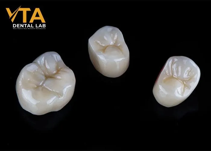 Ceramic-Crown-A-Popular-Choice-For-Permanent-Restoration