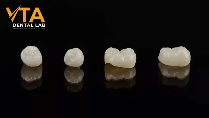 Ceramic-Crown-A-Popular-Choice-For-Permanent-Restoration