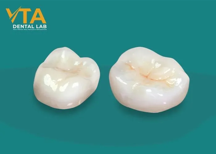 Ceramic-Crown-A-Popular-Choice-For-Permanent Restoration