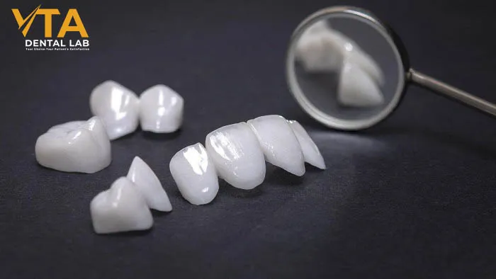 Crowns on A Broken Tooth: A Durable Solution