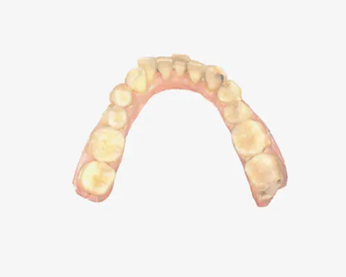 Intraoral Scanner2