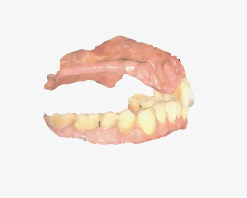Intraoral Scanner3