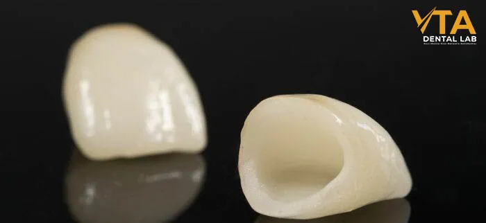 dental crown replacement