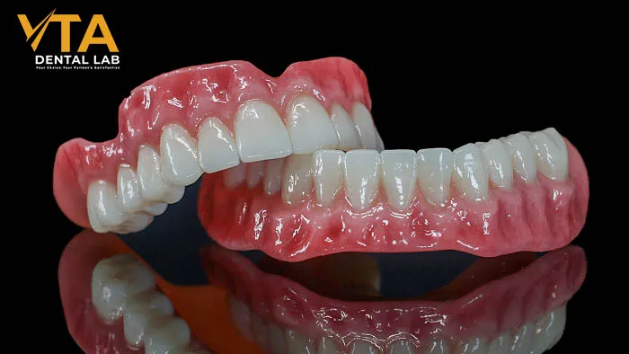 Acrylic Dentures: Features, Pros, and Cons Explained