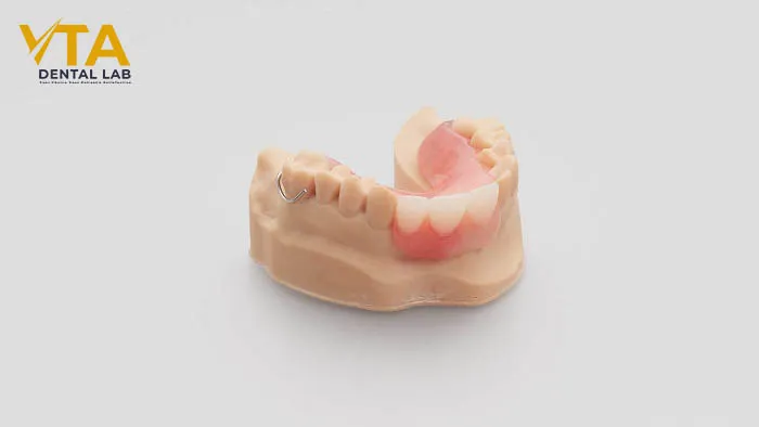 Acrylic Partial Denture: 5 Things To Know