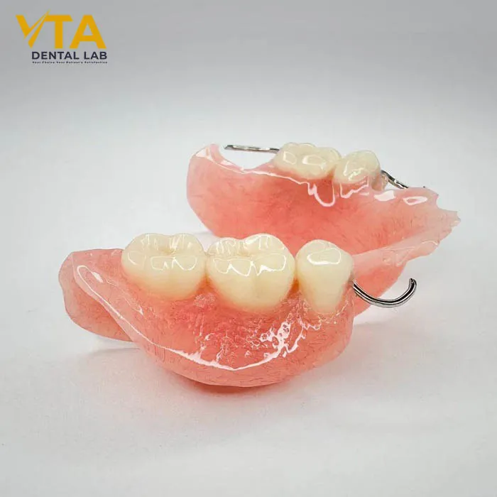 Close-up of an acrylic partial denture with acrylic base and metal clasps for posterior tooth replacement