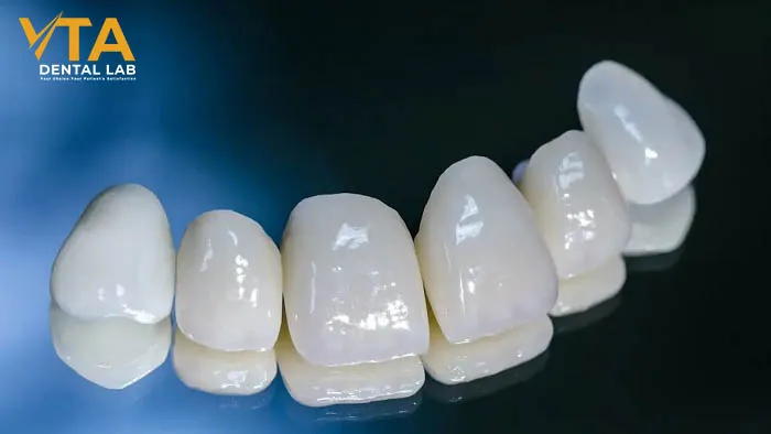eMax Crowns: Superior esthetics for your patients