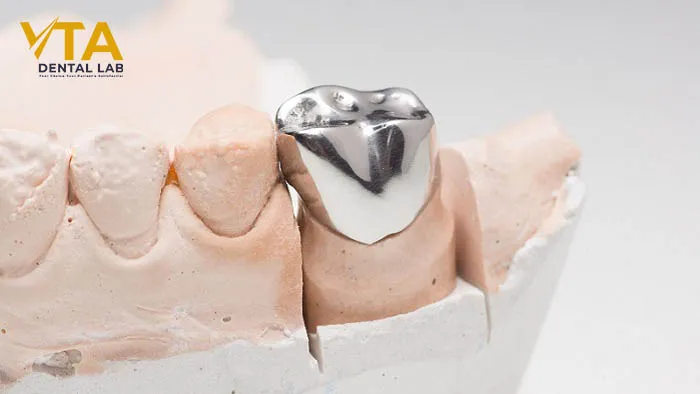 Metal Dental Crowns: Pros and Cons and Considerations