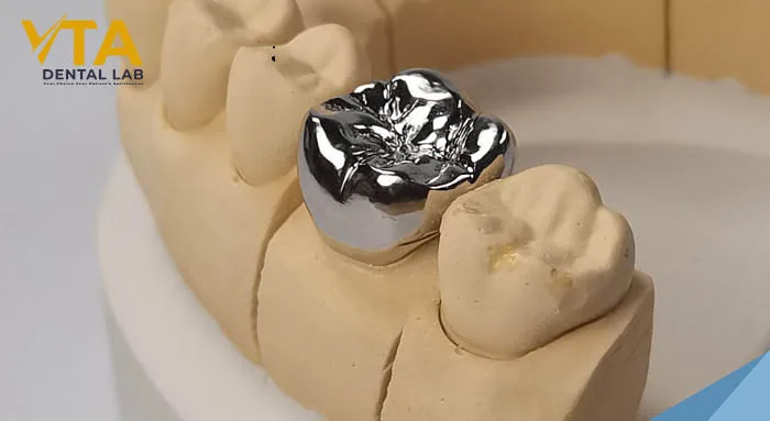 Metal crowns are less aesthetic but outperform ceramics in durability, making them suitable for molars under heavy occlusal forces