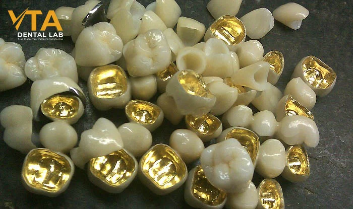 Explore how PFM Crowns vs Zirconia Crowns perform under pressure—durability tested in posterior regions