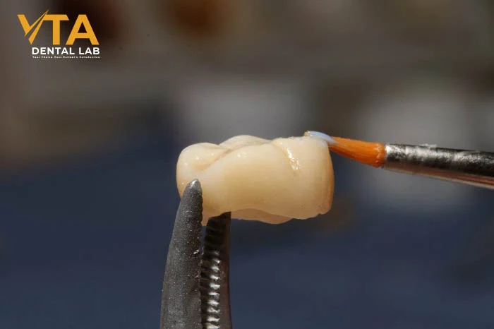 Porcelain crowns enhance both function and appearance for a confident smile