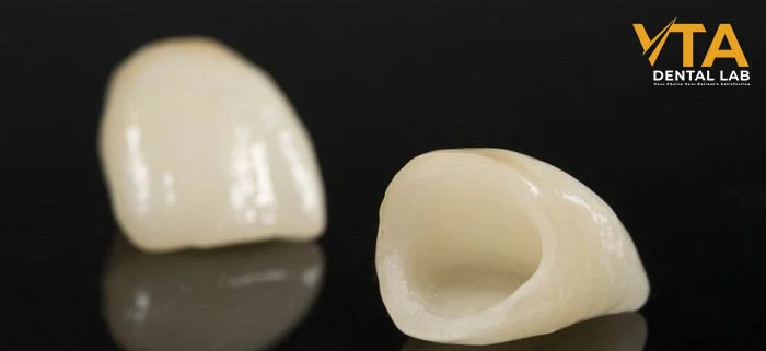 Full-contour zirconia crown offering exceptional durability for posterior restorations