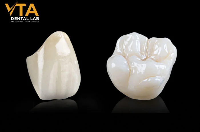 Porcelain crowns vs zirconia crowns comparison showing translucency and durability