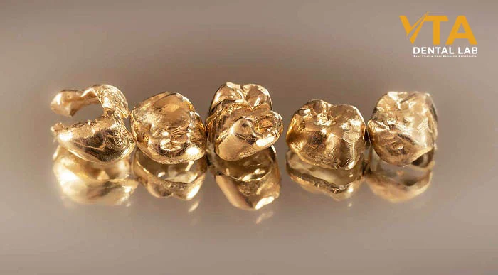 Metal dental crowns among the types of dental crowns are known for superior strength in molar restoration