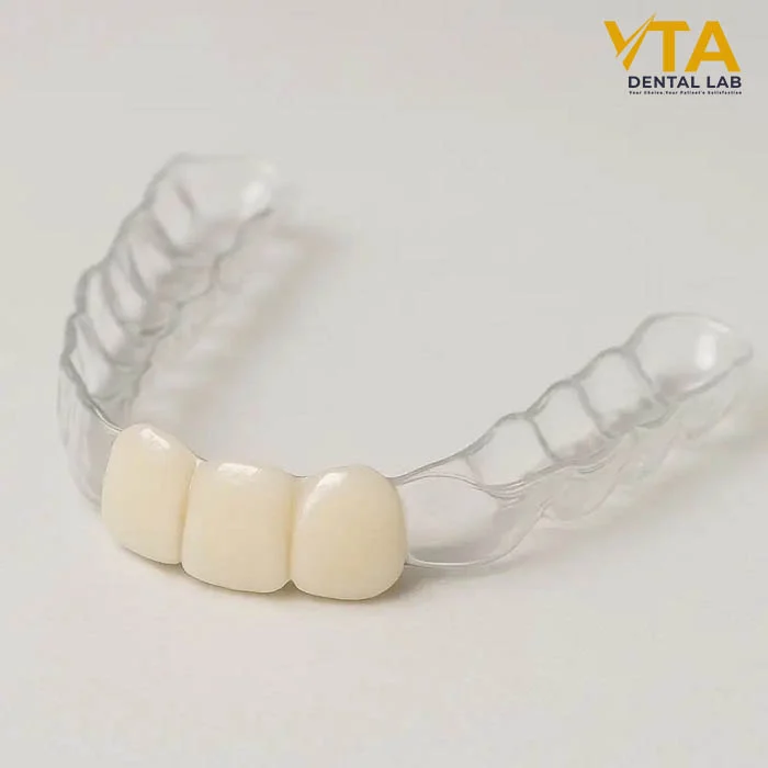 Essix Retainer on Dental Model