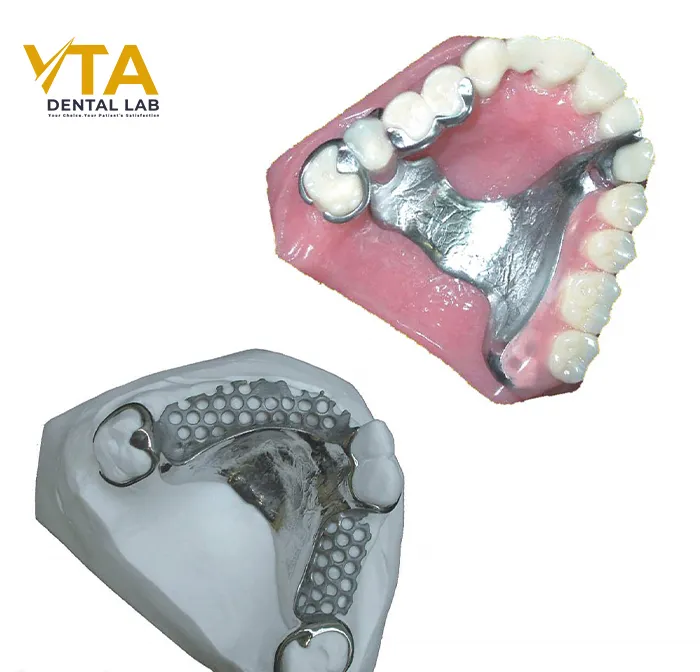 Built with high-quality metal for lasting strength and stability