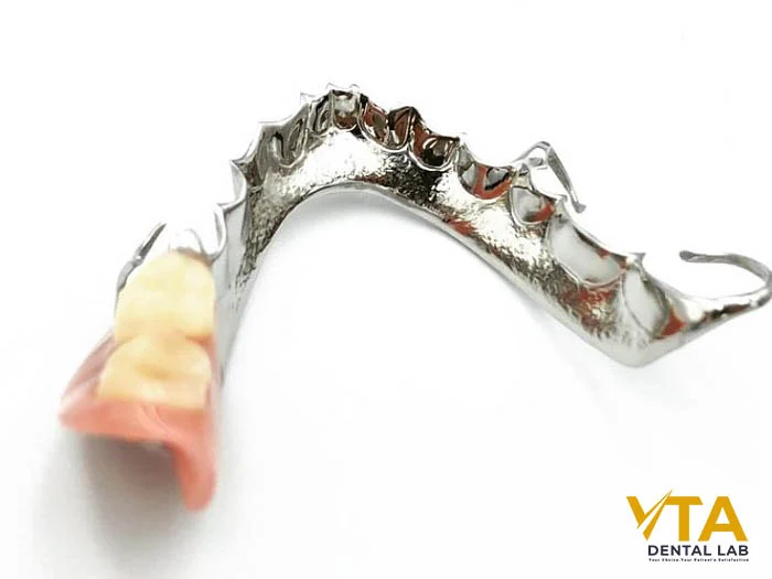Metal partial dentures that look and feel like your own teeth