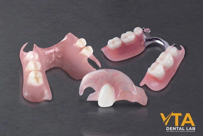 Metal partial dentures outperform acrylic in comfort and resilience