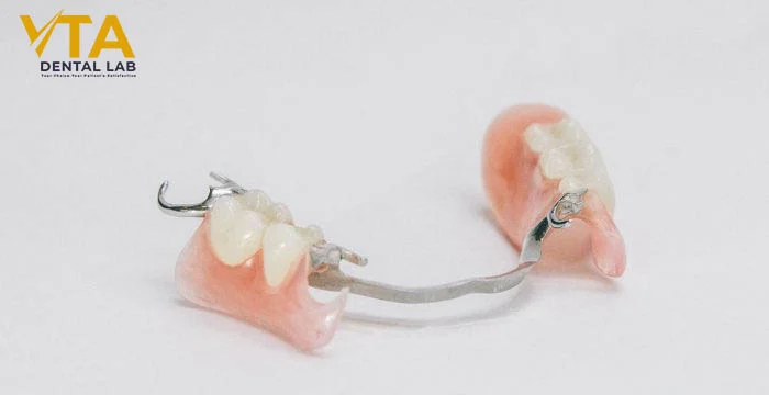 Custom-made partial denture created by dental lab for patient comfort