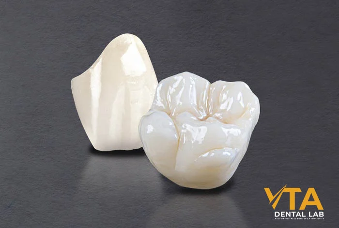 High Translucent Zirconia (HT Zirconia) is widely favored for anterior restorations due to its superior translucency
