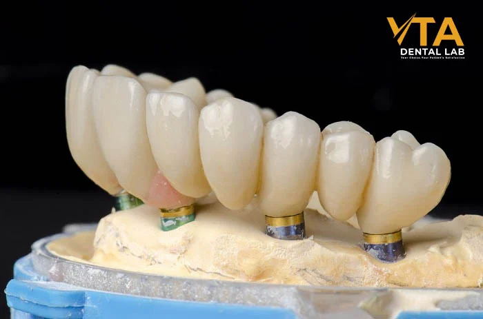 Each crown surface is carefully characterized to replicate natural grooves and anatomy