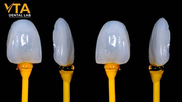 A Complete Guide to Veneer Preparation