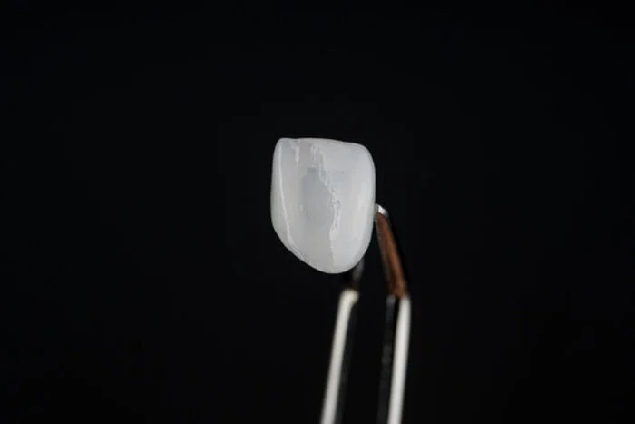 Side-by-side translucency test of E.max veneers vs porcelain veneers materials