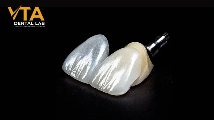 EMAX VENEERS: EVERYTHING YOU NEED TO KNOW