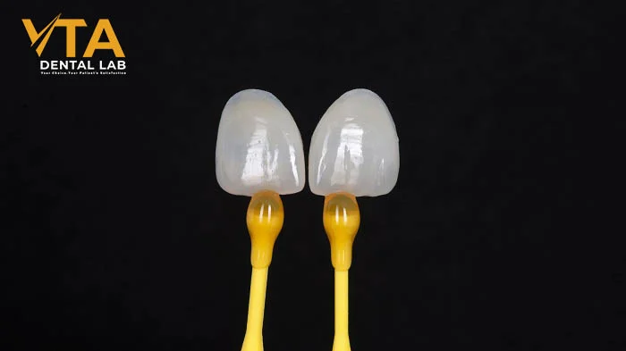 CAD/CAM digital design of E.max veneers before milling process