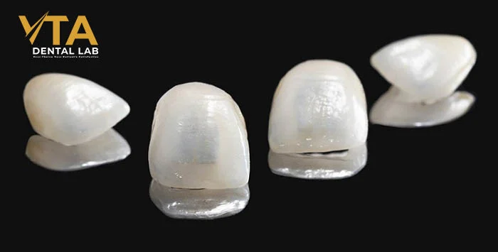 Feldspathic veneers