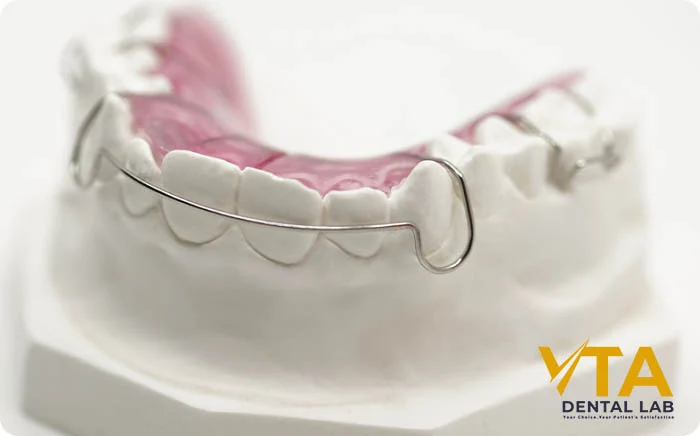 Close-up of a Hawley retainer with acrylic base and metal wire, placed on a dental model