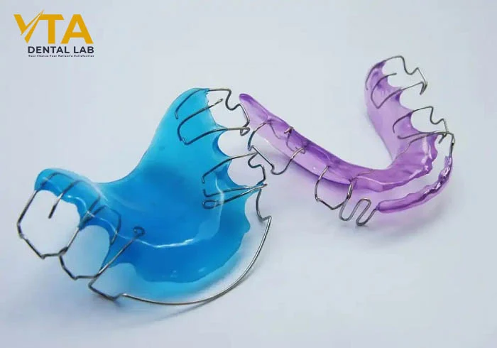 Hawley retainer with transparent acrylic base and precisely shaped Adams clasps for molar grip