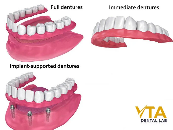 Types of full dentures