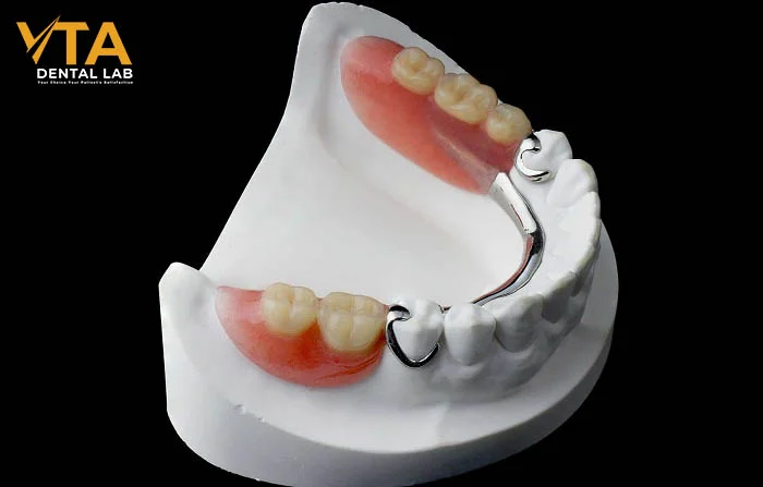 Removable dentures with natural tooth anatomy and a comfortable acrylic base